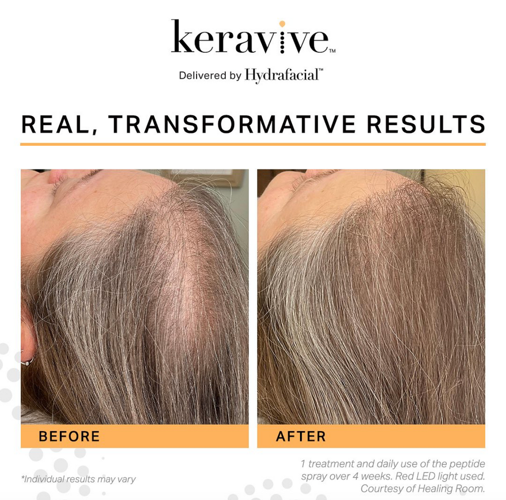 HYDRASCALP Keravive Spray