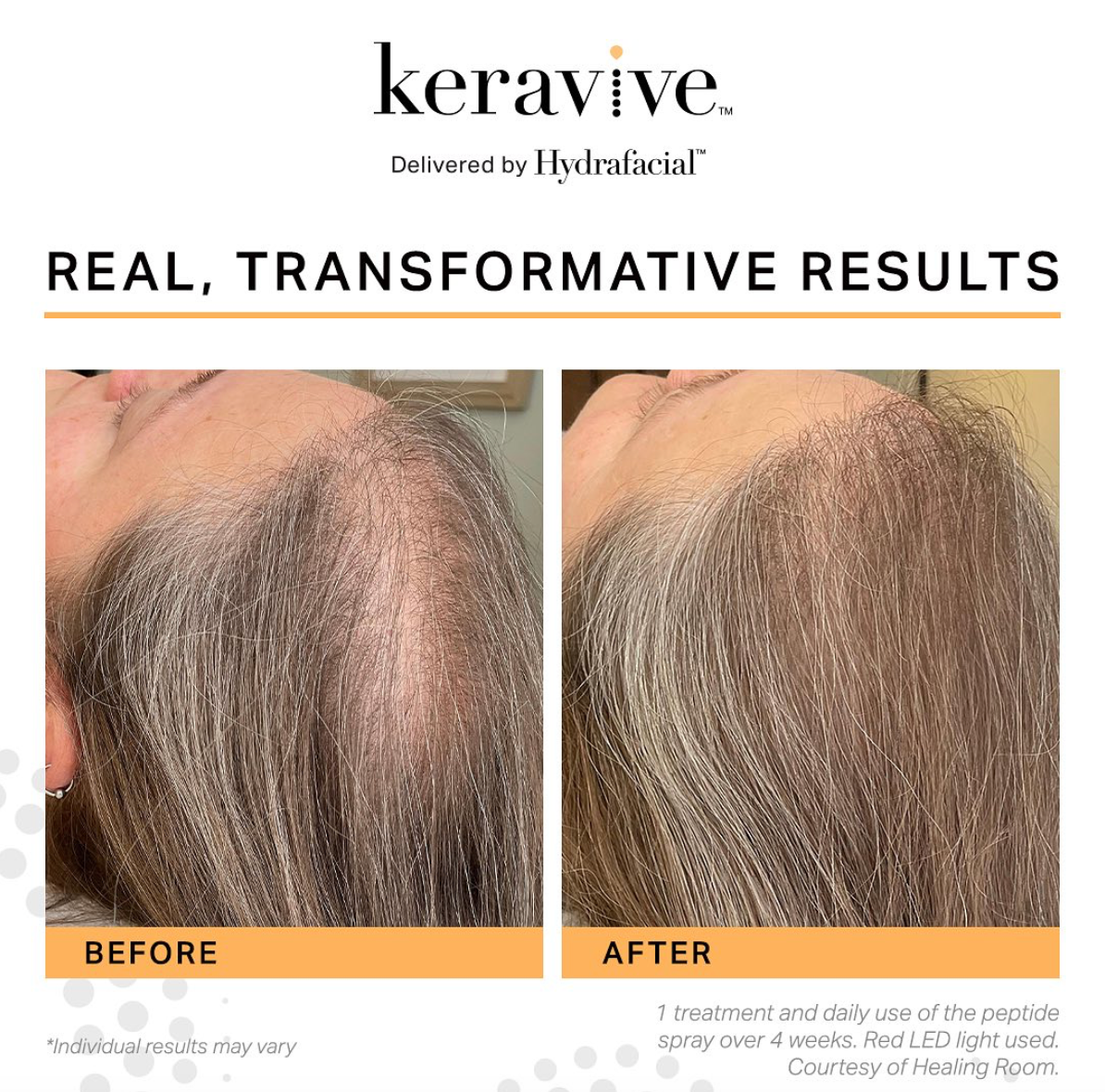 HYDRASCALP Keravive Spray